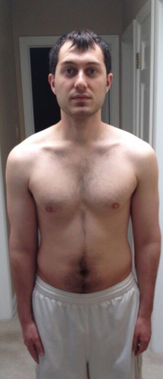 Before
