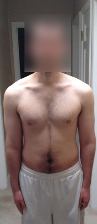 Before